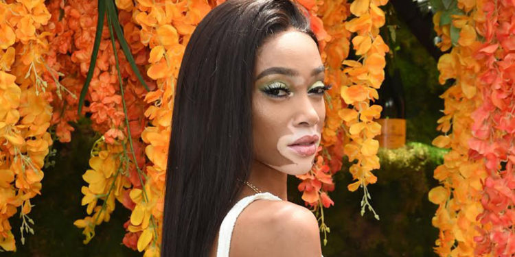 JERSEY CITY, NJ - JUNE 02:  Model Winnie Harlow attends the 11th annual Veuve Clicquot Polo Classic at Liberty State Park on June 2, 2018 in Jersey City, New Jersey.  (Photo by Jamie McCarthy/Getty Images for Veuve Clicquot)