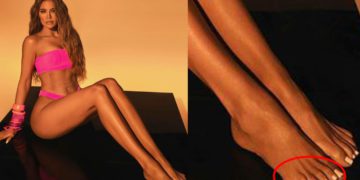 #OK! წარუმატებელი ფოტოშოპი და ფეხის მეექვსე თითი: ქლოი კარდაშიანის დამუშავებული ფოტო კრიტიკის ობიექტია