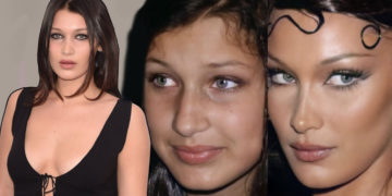 #OK! “ჯიჯიზე უშნო ვიყავი” – ბელა ჰადიდმა აღიარა, რომ ცხვირის ოპერაცია 14 წლის ასაკში გაიკეთა