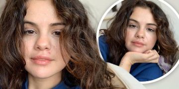 #OK! “გამონაყარი სირცხვილი არ არის, ის უმაკიაჟოდაც ძალიან ლამაზია” – სელენა გომეზი ინსტაგრამზე ახალ ფოტოებს აქვეყნებს