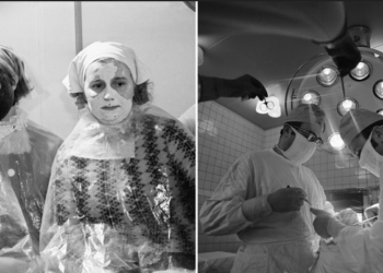 #OK! როგორი იყო პლასტიკური ქირურგია საბჭოთა კავშირში