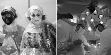 #OK! როგორი იყო პლასტიკური ქირურგია საბჭოთა კავშირში